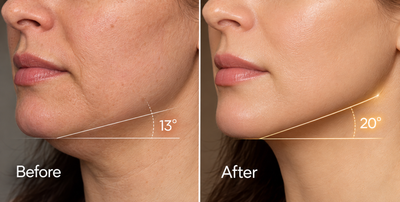 Veloura LiftWave™ — Microcurrent & Red Light Facial Sculpting Device